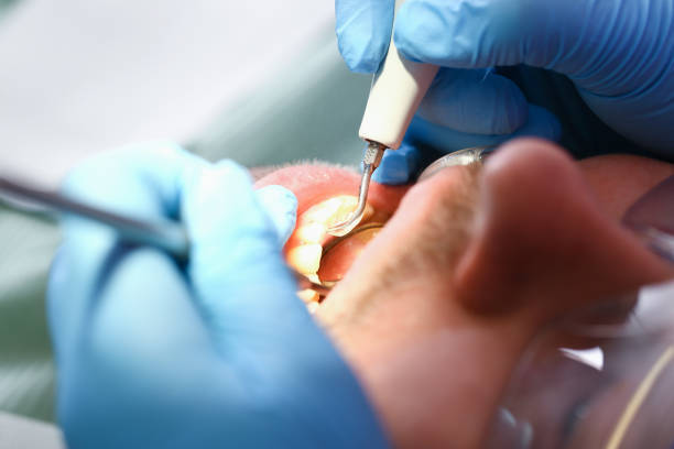 Best Emergency TMJ Treatment in Fort Belvoir, VA