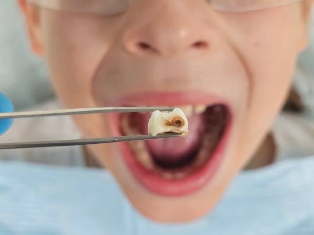 Best Urgent Care for Lost Fillings or Crowns in Fort Belvoir, VA