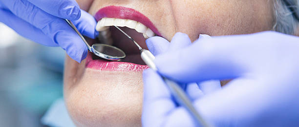 Best Emergency Treatment for Dental Infections or Abscesses in Fort Belvoir, VA